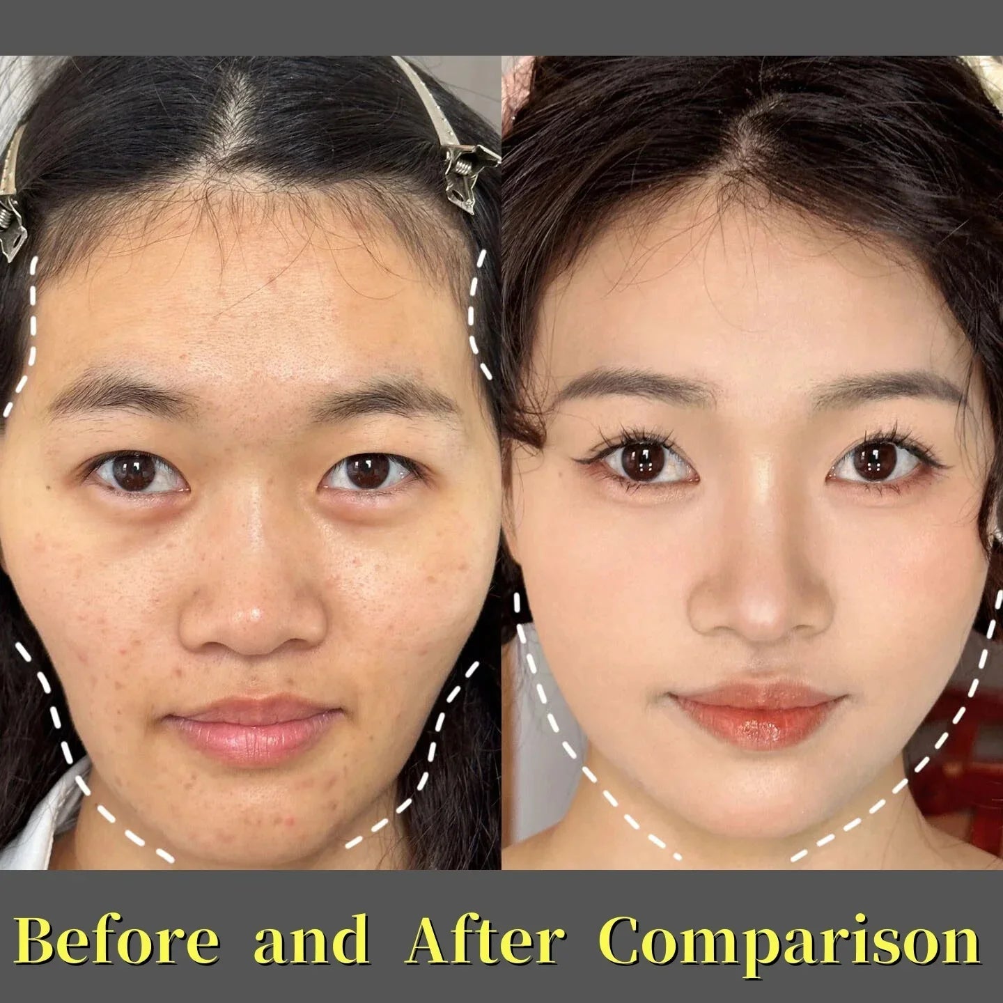 Patch hydrocristallin raffermissant des ridules, Anti-âge, Lifting, affaissement de la peau du visage, masques de nutrition en profondeur, produits de soins du visage coréens