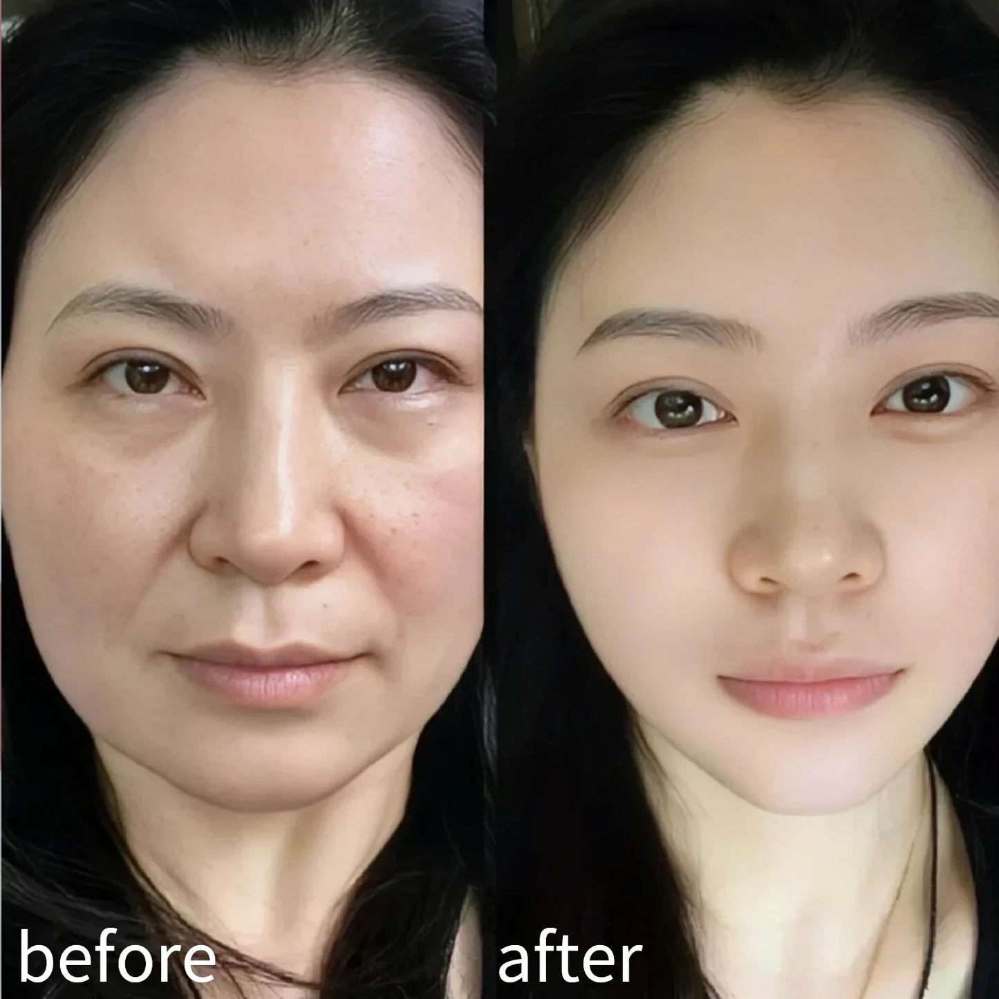 1/5 rouleaux visage V ligne cou yeux bande de levage respirant réduire les rides du visage soutient pansement élastique outil de soins de la peau du visage