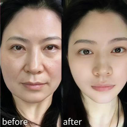 1/5 rouleaux visage V ligne cou yeux bande de levage respirant réduire les rides du visage soutient pansement élastique outil de soins de la peau du visage