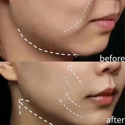 1/5 rouleaux visage V ligne cou yeux bande de levage respirant réduire les rides du visage soutient pansement élastique outil de soins de la peau du visage